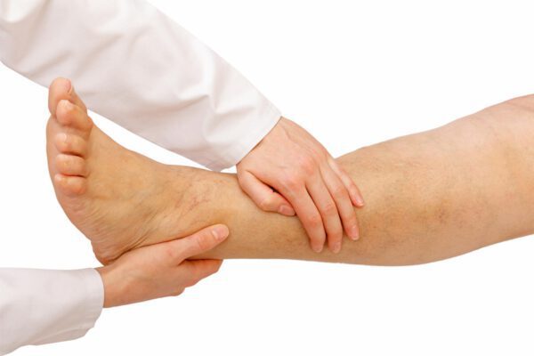 Oedeemtherapie